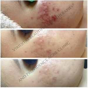 Viriditas Beautiful Skin Therapies bna #6(2)