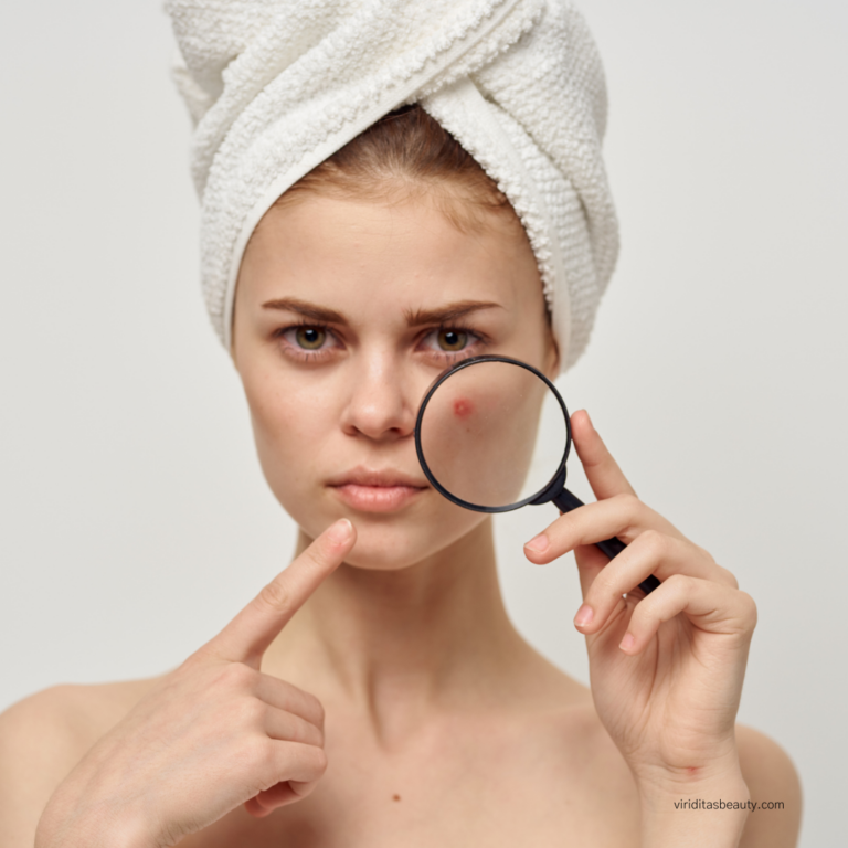 a young woman points to a red blemiah on her sheek that is highlighted with a magnifying glass